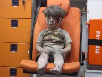Un niño herido durante un bombardeo en Alepo Un niño herido durante un bombardeo en Alepo