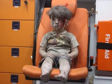 Un niño herido durante un bombardeo en Alepo Un niño herido durante un bombardeo en Alepo