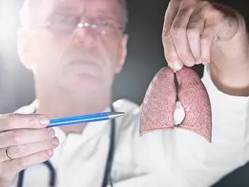 Un inhalador triplica la supervivencia en un tipo de cáncer de pulmón Un inhalador triplica la supervivencia en un tipo de cáncer de pulmón