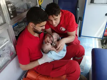 Dos siameses fallecen al no poder ser evacuados e otro país Dos siameses fallecen al no poder ser evacuados e otro país