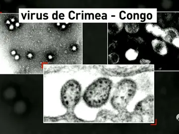 Virus Crimea Congo Virus Crimea Congo
