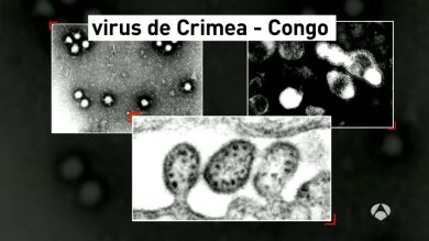 La muerte producida por la fiebre Crimea Congo, primer caso en Europa Occidental