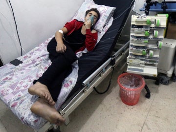 Un civil respira a través de una máscara de oxígeno en el hospital al-Quds, tras uno de los ataques químicos en agosto
