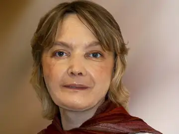 Isabelle Dinoire, la mujer francesa sometida en 2005 al primer trasplante parcial de cara del mundo Isabelle Dinoire, la mujer francesa sometida en 2005 al primer trasplante parcial de cara del mundo