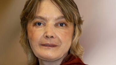 Muere Isabelle Dinoire, la primera mujer del mundo en someterse a un trasplante de cara