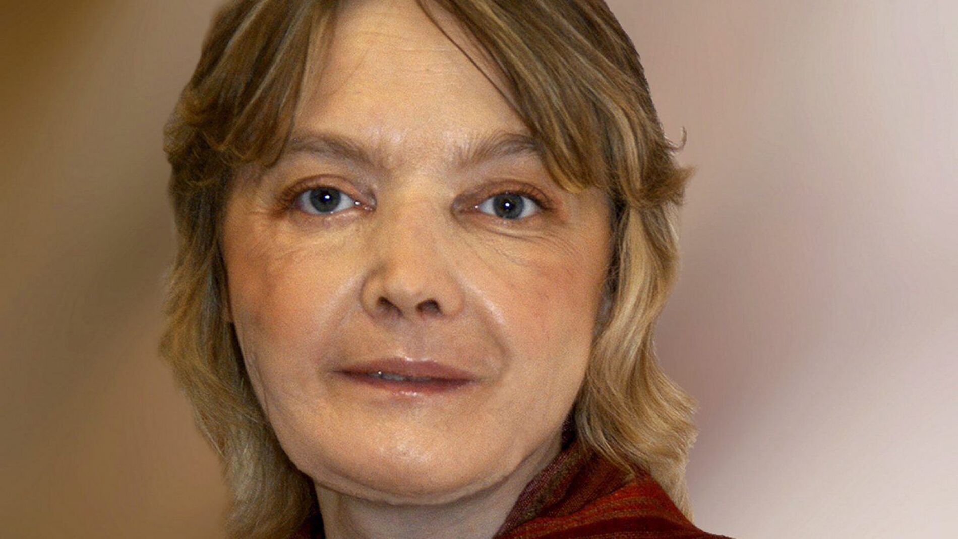 Isabelle Dinoire, la mujer francesa sometida en 2005 al primer trasplante parcial de cara del mundo