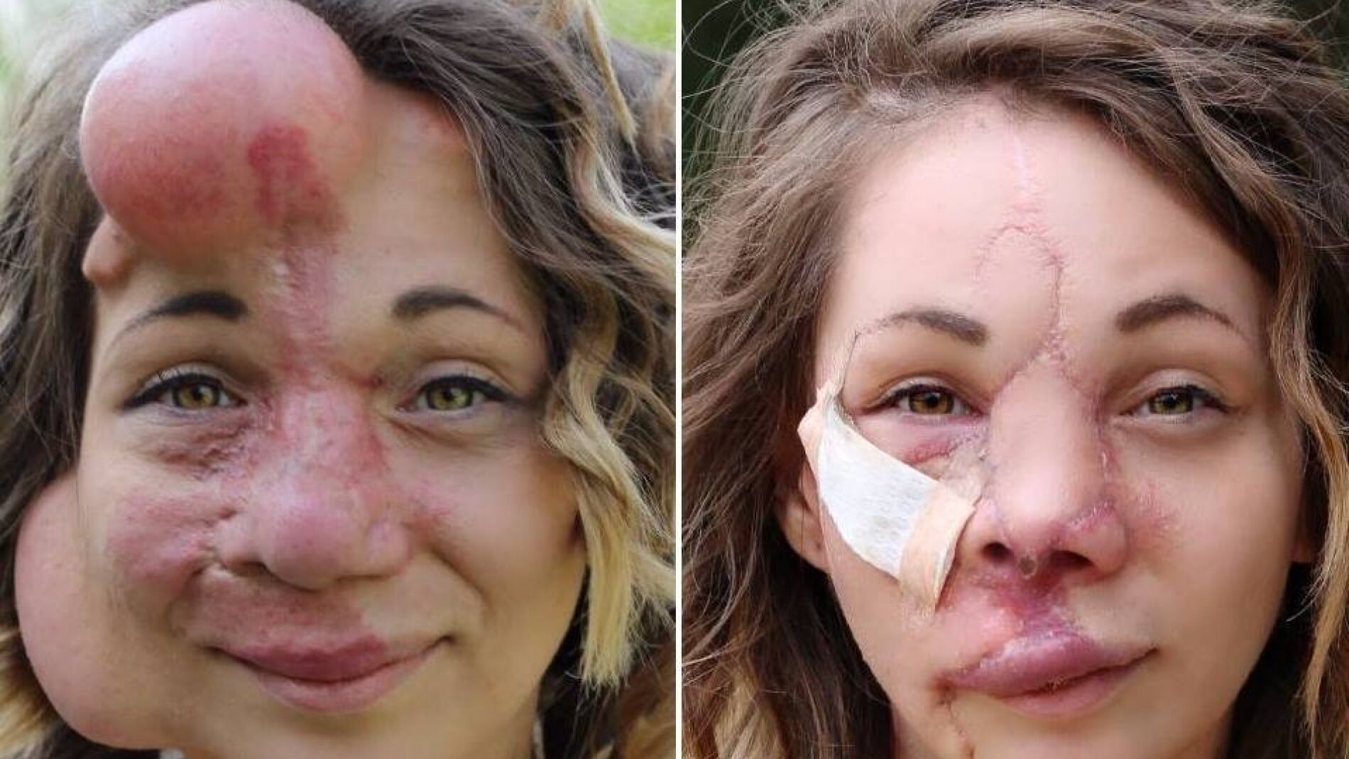 El cambio tras las operaciones