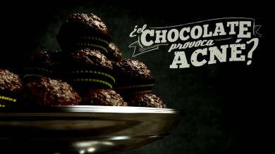 ¿El chocolate provoca acné?
