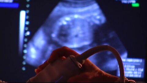 Frame 3.374143 de: Riesgos y consecuencias de la maternidad tard&iacute;a