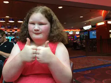 Niña con el extraño síndrome por el que tiene siempre hambre Niña con el extraño síndrome por el que tiene siempre hambre