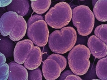 Neisseria gonorrhoeae, la bacteria que provoca la gonorrea