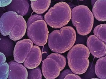 Neisseria gonorrhoeae, la bacteria que provoca la gonorrea Neisseria gonorrhoeae, la bacteria que provoca la gonorrea
