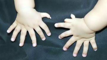Los 15 dedos de las manos de un bebé chino