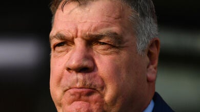 Allardyce, autocrítico: 