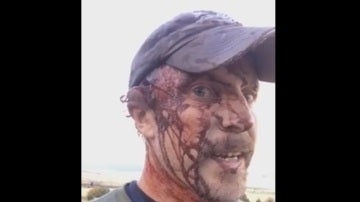 Todd Orr, un hombre que ha sobrevivido a dos ataques de una osa