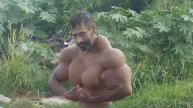 Un hombre se inyecta aceite para que sus bíceps crezcan hasta los 79 centímetros
