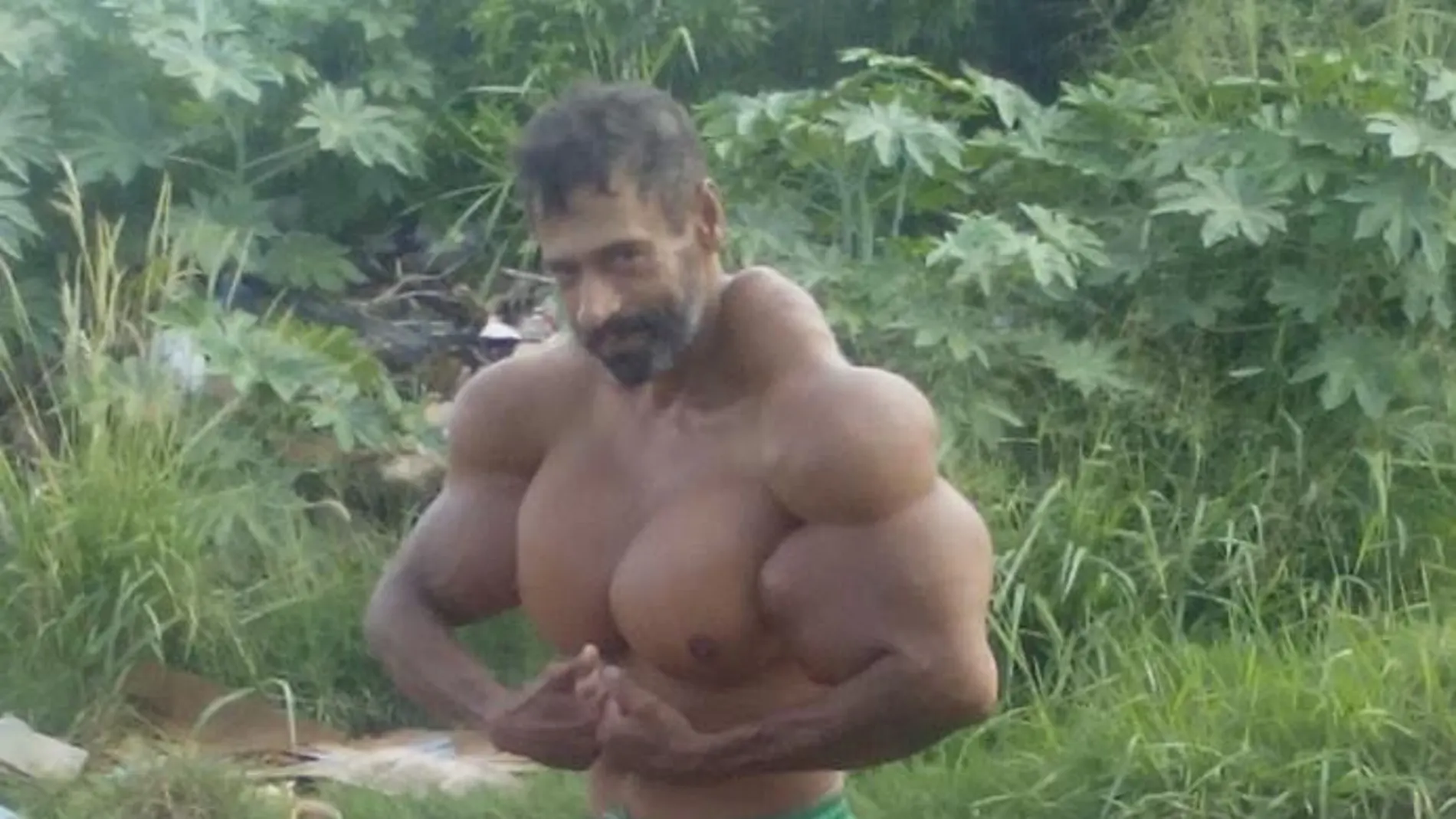 Valdir Segato, el hombre que se inyecta aceite para que sus bíceps crezcan Valdir Segato, el hombre que se inyecta aceite para que sus bíceps crezcan