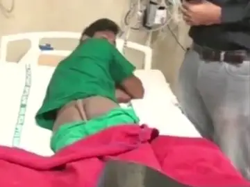 El joven de 18 años,nació con una cola parecida a la de un animal El joven de 18 años,nació con una cola parecida a la de un animal