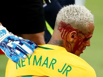 Neymar, con el rostro ensangrentado tras recibir un codazo Neymar, con el rostro ensangrentado tras recibir un codazo