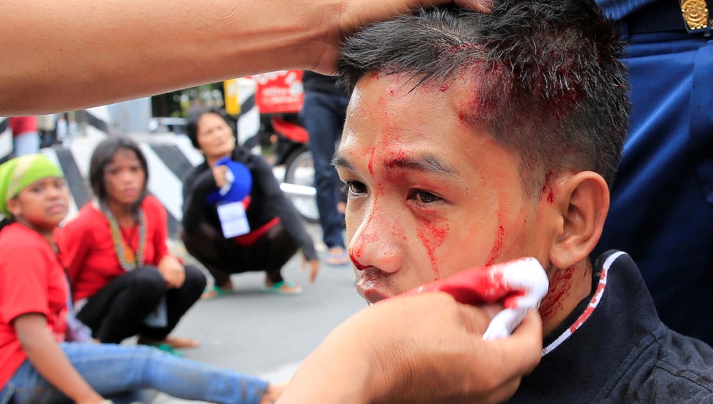 Un joven herido en las protestas