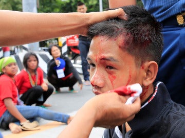 Un joven herido en las protestas