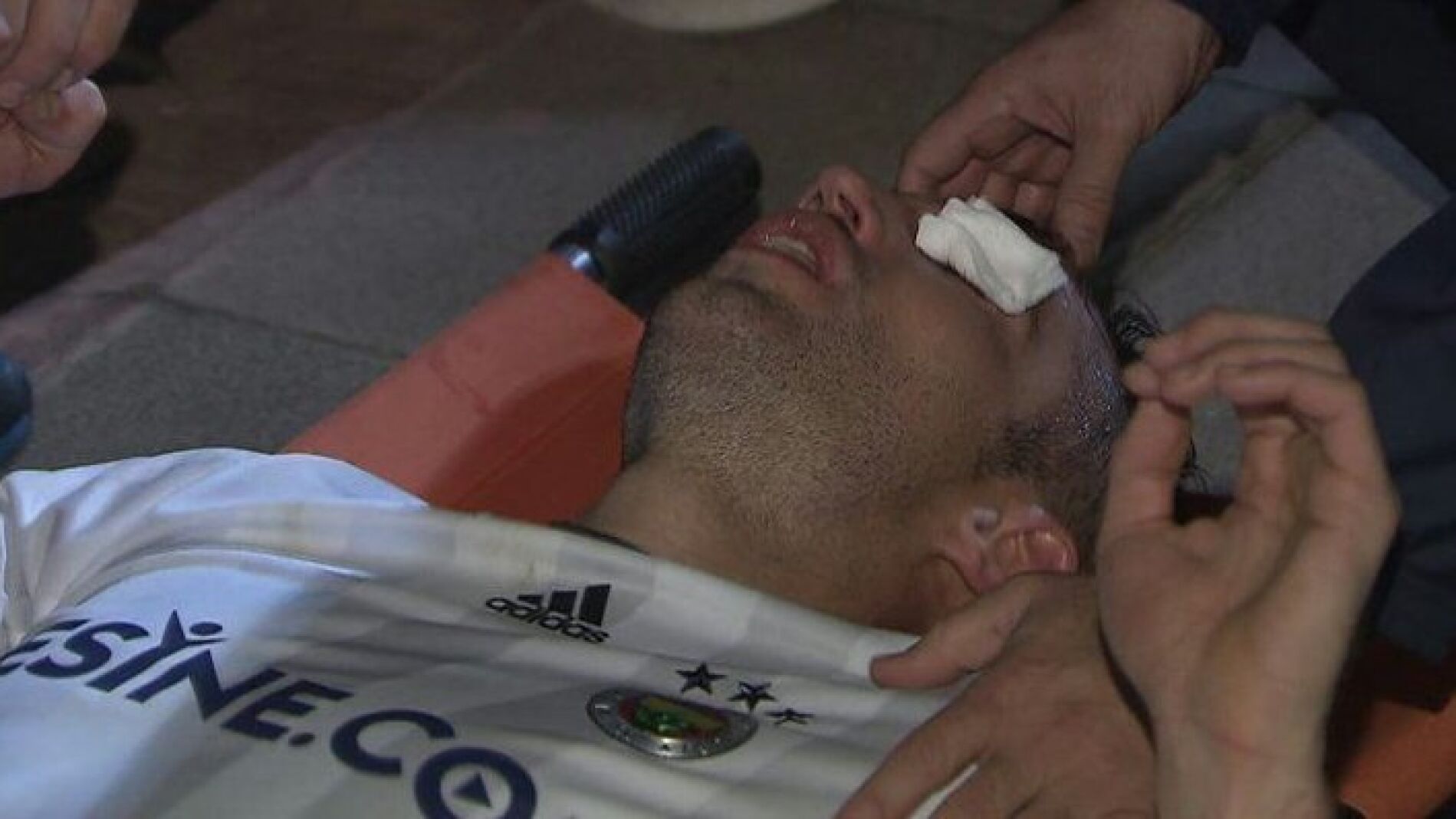 Van Persie, tras sufrir el codazo que casi le hace perder un ojo