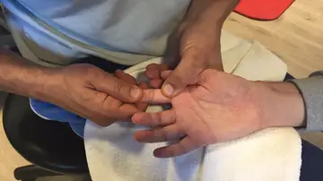 Bruno Hortelano muestra su mano derecha Bruno Hortelano muestra su mano derecha