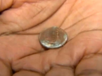 La moneda que un bebé tenía atrancada en la garganta