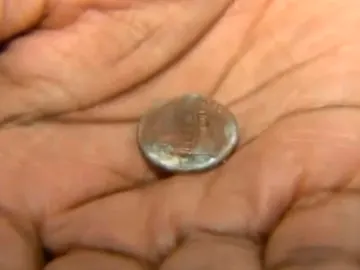 La moneda que un bebé tenía atrancada en la garganta La moneda que un bebé tenía atrancada en la garganta