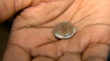 La moneda que un bebé tenía atrancada en la garganta