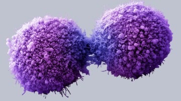 Células de páncreas cancerosas completando la división celulas