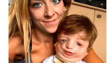 Oleada de solidaridad para ayudar a un niño con una enfermedad que le afecta a los huesos, la piel, los oídos y la respiración