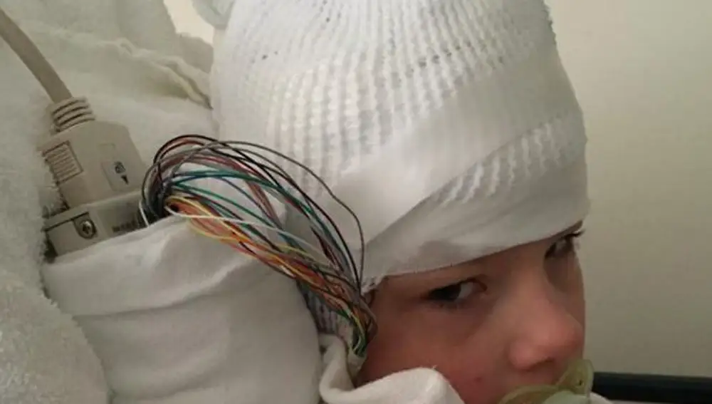 El pequeño Billy en el hospital El pequeño Billy en el hospital