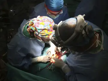 Un quirófano durante un trasplante Un quirófano durante un trasplante