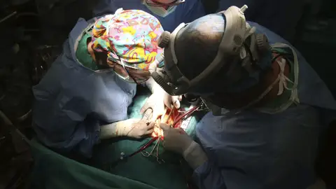 Un quirófano durante un trasplante Un quirófano durante un trasplante de corazón