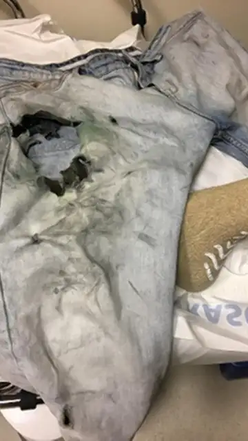 Los vaqueros quemados donde llevaba el cigarrillo Los vaqueros quemados donde llevaba el cigarrillo
