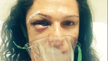 Ana Guevara, excampeona olímpica, sufre una brutal agresión