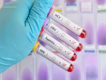 Infecciones de transmisión sexual Infecciones de transmisión sexual