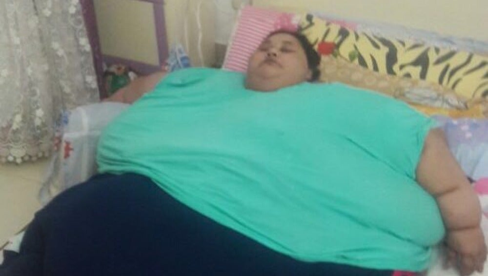 Mujer obesa es operada 