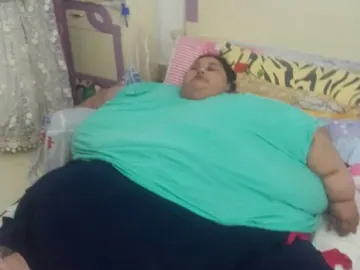 Mujer obesa es operada Mujer obesa es operada