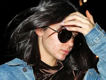 Kendall Jenner granos Kendall Jenner granos