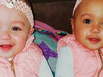 Kalani y Jarani, las gemelas de diferente raza Kalani y Jarani, las gemelas de diferente raza