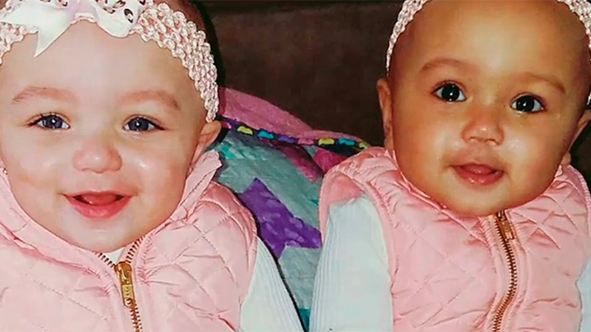Kalani y Jarani, las gemelas de diferente raza