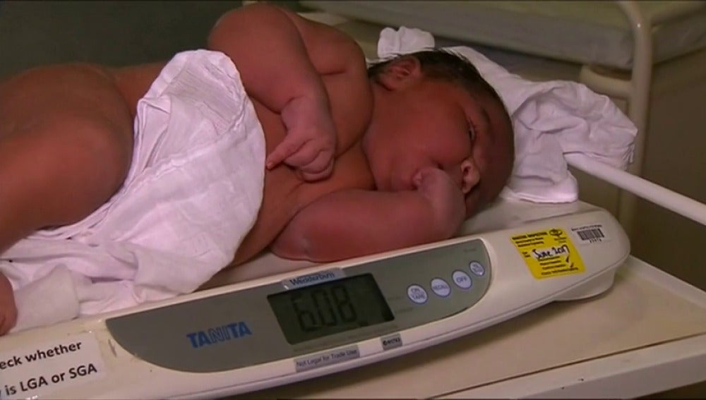 Frame 10.266666 de: Un bebé pesa más de 6 kilos al nacer 