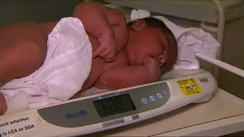 Frame 10.266666 de: Un bebé pesa más de 6 kilos al nacer Frame 10.266666 de: Un bebé pesa más de 6 kilos al nacer