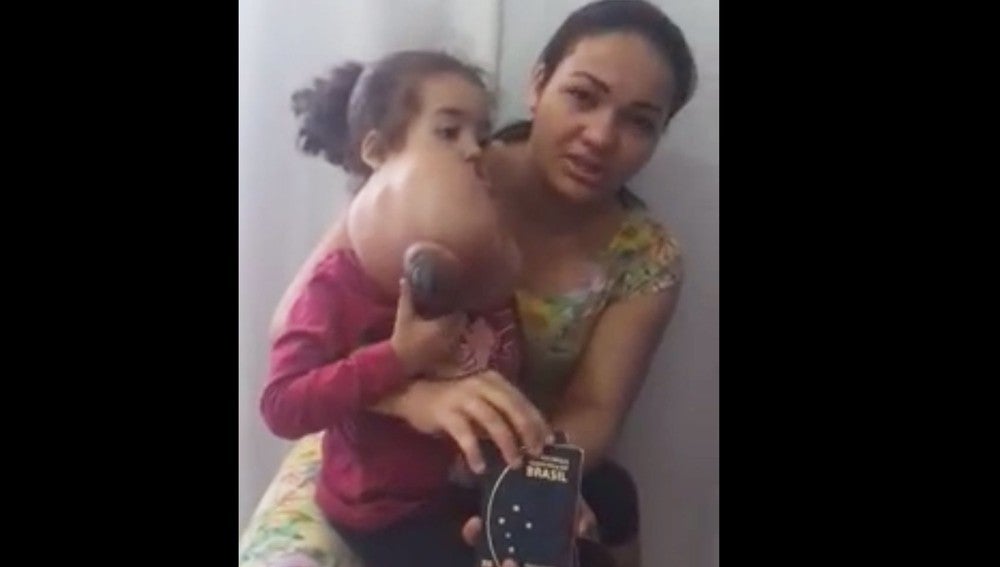 La madre de Melyssa junto a la niña antes de la operación