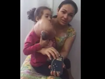 La madre de Melyssa junto a la niña antes de la operación La madre de Melyssa junto a la niña antes de la operación