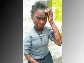 Niña serpiente Niña serpiente