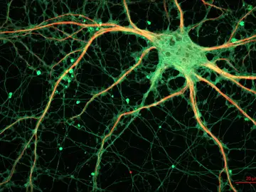 Imagen de una neurona vista al microscopio Imagen de una neurona vista al microscopio