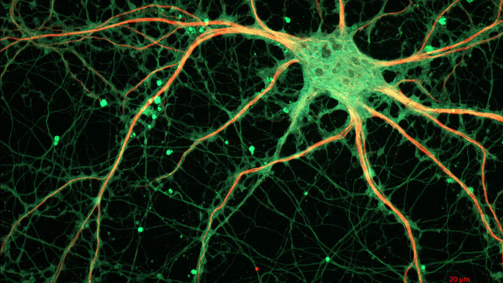 Imagen de una neurona vista al microscopio Imagen de una neurona vista al microscopio